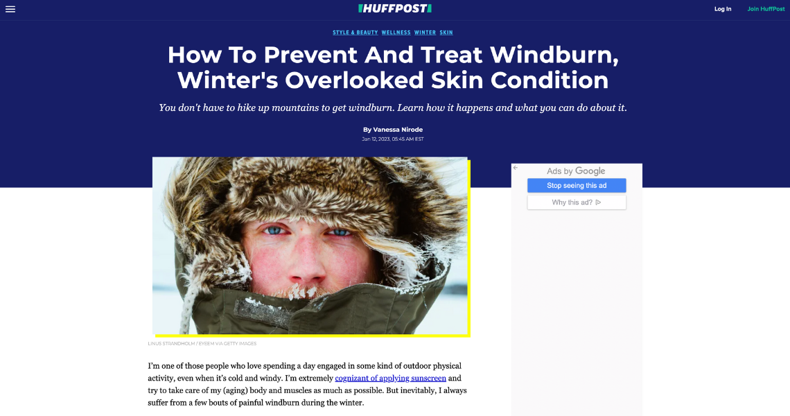 How To Prevent And Treat Windburn Winters Overlooked Skin Condition