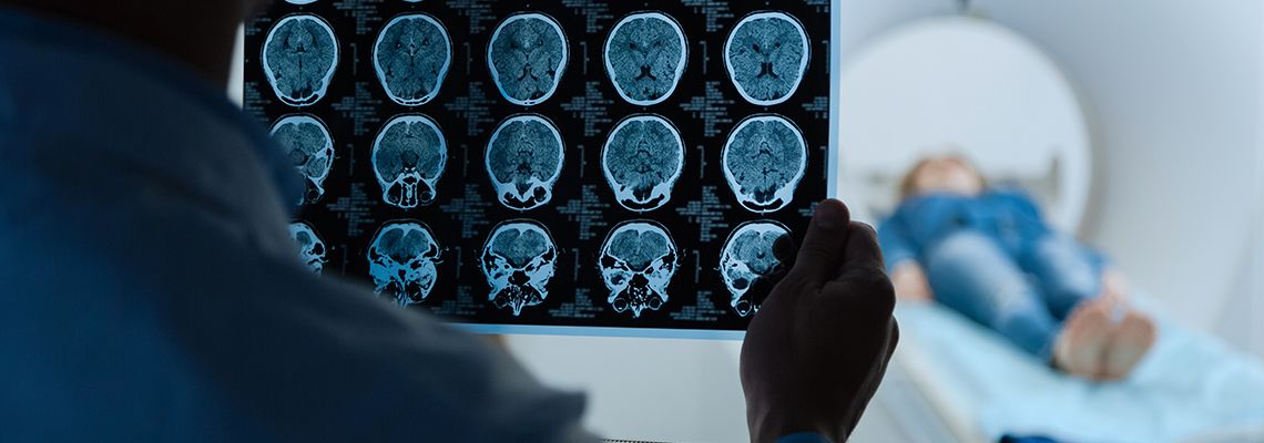 brain scans