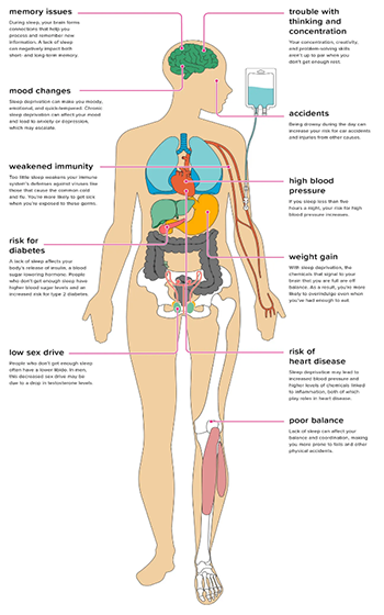 Diagram of a human body explaining the various effects of sleep deprivation on various body systems