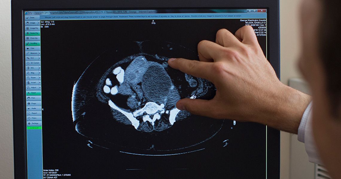 Doctor looking at a scan on a monitor