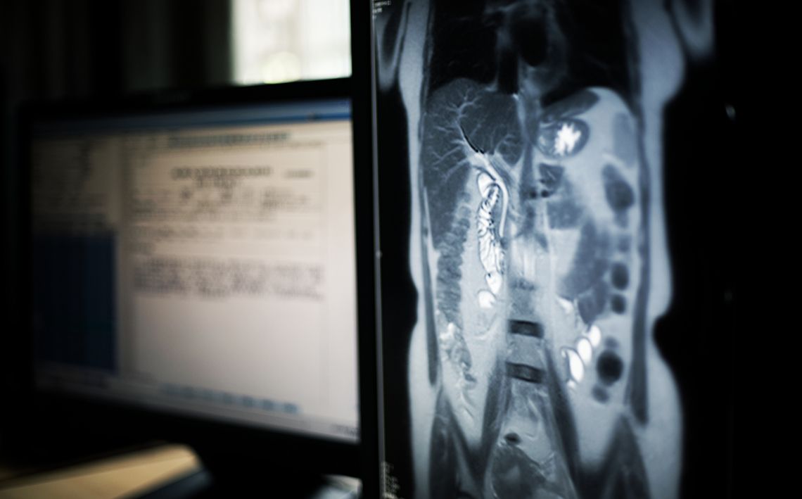 x-ray of pancreas and liver
