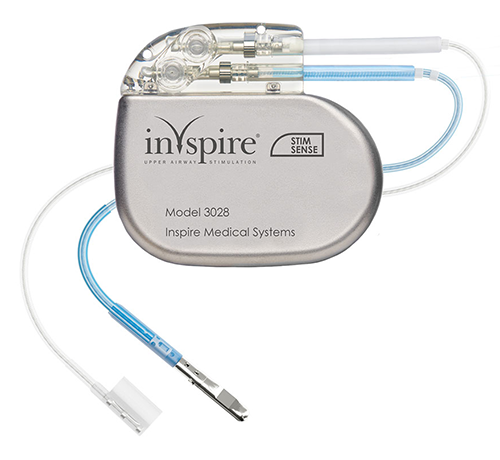 Inspire implant