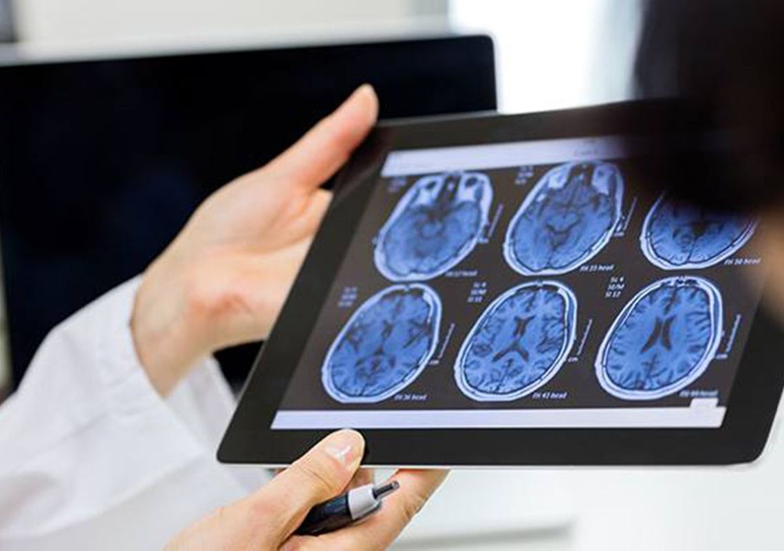 scans of the brain on a tablet