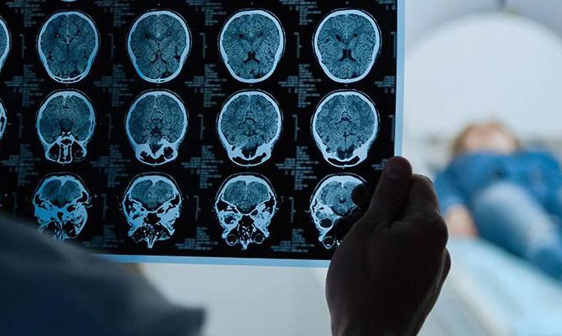 Someone looking at brain scans