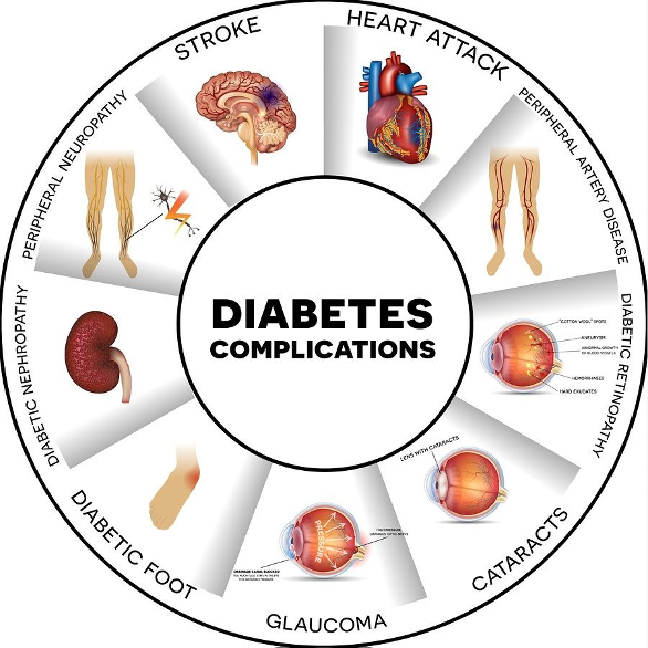Diabetes Complications diagram