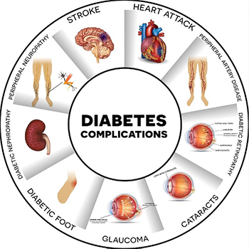 Diabetes Complications diagram