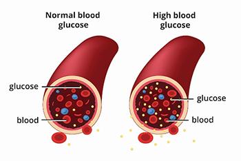 normal blood glucose vs high blood glucose diagram
