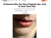12 Reasons Why You Have Chapped Lips—And How To Heal Them Fast